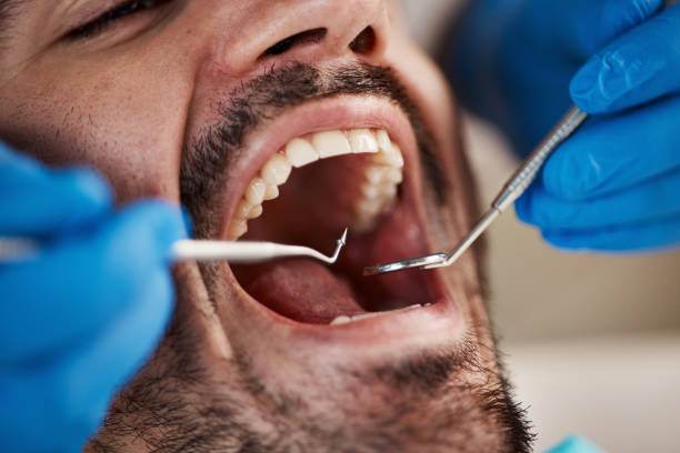 Best Emergency Tooth Extraction in Edmonton, KY