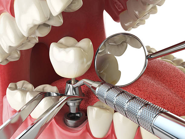 Best Pediatric Emergency Dentist in Edmonton, KY
